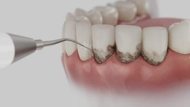 Reliable Emergency Dentist contractor in Pickerington, OH by Smile Center Dentistry